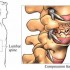 مقاله ساختار و نقش استخوان و اسکلت در بدن انسان