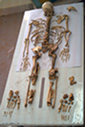مقاله استخوان شناسی